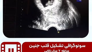 موضوع: سونوگرافی تشکیل قلب جنین