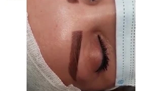 بازگشت همه به سمت کاشت ابروست!| کلینیک ابروان