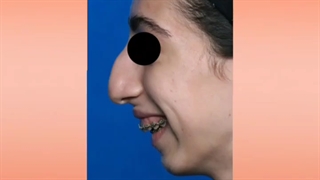 جراحی فک و صورت