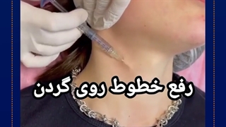 مزوتراپی چین و چروک گردن پوسیدگی دندان