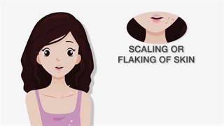 علائم خطرناک حساسیت پوستی