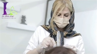 میدونستین کربوکسی تراپی روشی هست که میشه باهاش ریزش مو رو درمان کرد ؟!