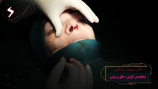 عمل بینی گوشتی و پهن در اتاق عمل