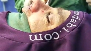 لایو زنده جراحی بینی