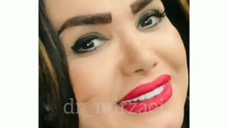 اصلاح طرح لبخند