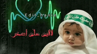 لالا لالا علی اصغر (ع) جراحی بینی