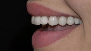 مرکز ایمپلنت دکتر دهقان