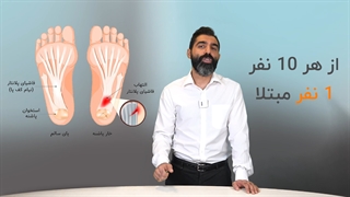 توضیحات در مورد خار پاشنه توسط دکتر محمد حسین دلشاد کامپوزیت ونیر