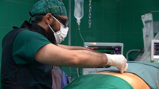 RF یا رادیوفرکوئنسی های فست های کمری