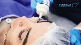 فیلم کامل جوانسازی صورت