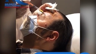 فیلم واقعی از تزریق بوتاکس برای آقایان در مطب دکتر مولازاده
