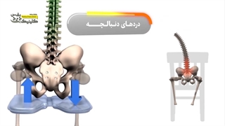 درمان دردهای دنبالچه
