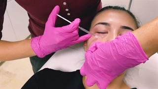 مزوتراپی ،پیشرفته ترین روش رفع سیاهی زیر چشم