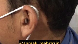 سمعک پشت گوشی