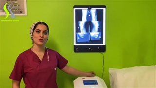 فیلم درمان استئوتومی زانو برای بازیکن اسبق فوتبال کشورمان