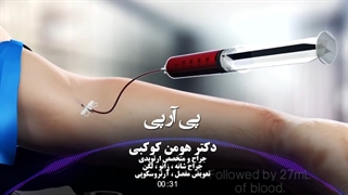 تاثیرات شگفت انگیز prp در درمان آرتروز و آسیب های تاندونی