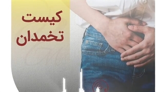 کیست تخمدان