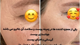 فیلم تزریق مزوژل جالپرو و نتیجه باورنکردنی جوانسازی صورت دندان مصنوعی
