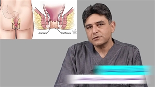 فرق شقاق و هموروئید