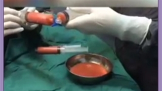 هزینه تزریق چربی به گودی بغل ران جراحی گوش