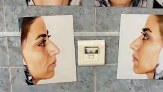 لایو جراحی بینی