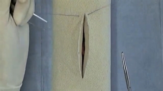 آموزش زدن بخیه ممتد(پیوسته)