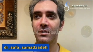 جراحی زیبایی بینی