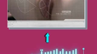 انیمیشن لابیاپلاستی