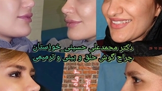 جراحی بینی در اهواز