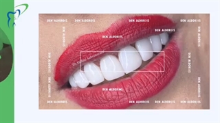 فیلم زیبایی دندان