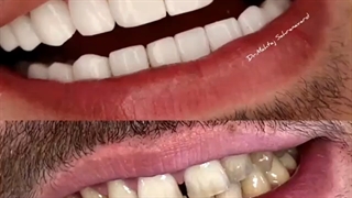 فیلم انجام کامپوزیت