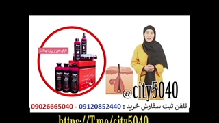 تلفن مشاوره شامپو ضد ریزش مو ریز 09120852440