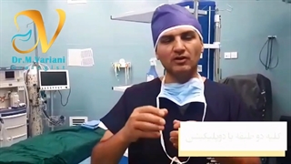 کلیه دو طبقه