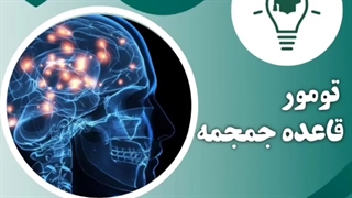 تومور قاعده جمجمه