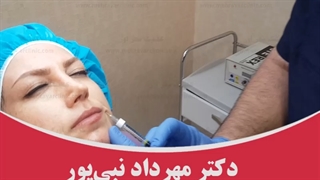 رفع خط بغض با نخ