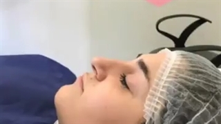 بهترین مرکز برای لیفت بینی در تهران کلینیک الهیه