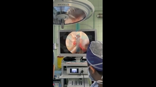 عمل جراحی دکتر رضا اشراقی با دوربین پزشکی Surgical Camera ترمیم دندان
