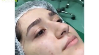جراحی زیبایی بینی