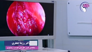 آیا جراحی پولیپ و سینوس با لیزر انجام می شود؟!