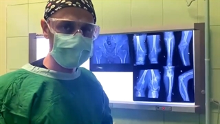 تومورهای خوش خیم استخوان