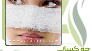 چه کسانی رینوپلاستی انجام ندهند؟