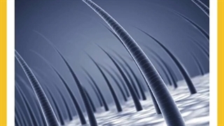 علت ریزش مو