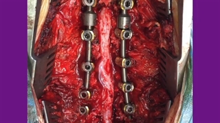 خانم 77 ساله با ضعیفی پاها