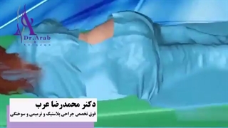 تزریق چربی چگونه انجام می شود؟