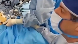 بیوپسی کبد در اسیلو معده