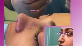 جراحی زیبایی بینی
