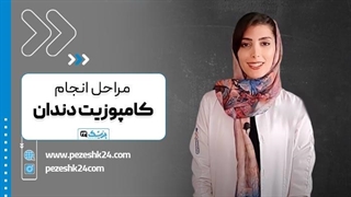 فیلم کامپوزیت دندان + کامپوزیت دندان چگونه انجام میشود؟