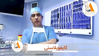 کایفوپلاستی چیست؟