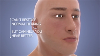 کلینیک خرید سمعک موج