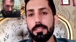 کاشت مو رنسانس